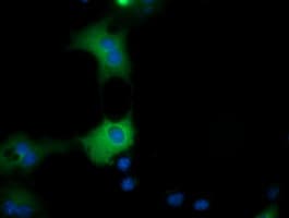QPRT Antibody (clone OTI2H4)