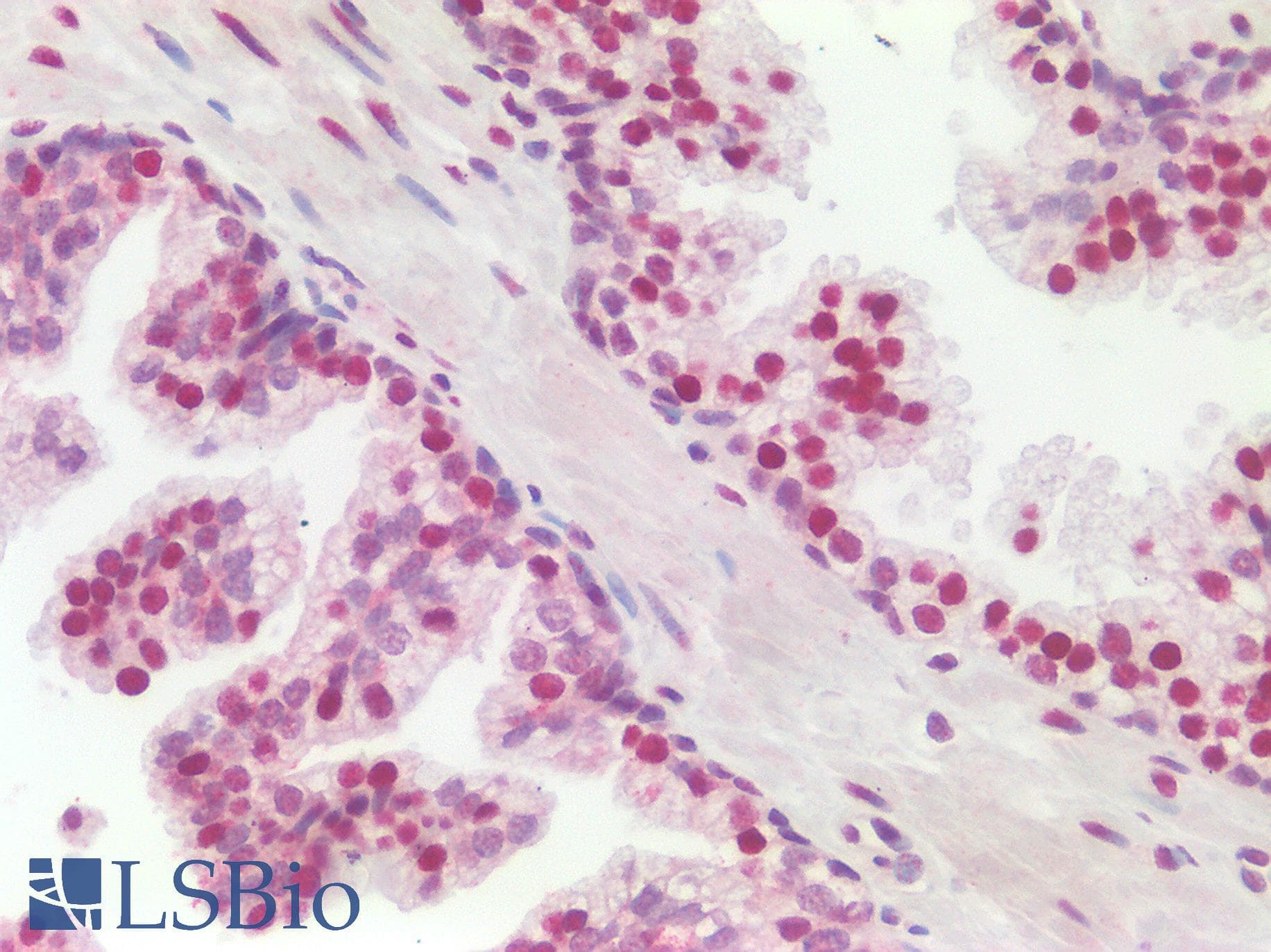 PathPlus™ Polyclonal Rabbit anti-Human SSB / La Antibody (aa366-397, IHC, WB)