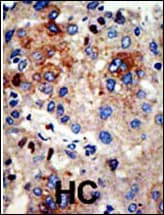HDAC9 Antibody (aa2-32)