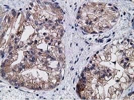 KCTD14 Antibody (clone OTI1D11)