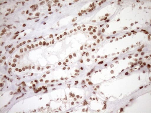 EXOSC1 / CSL4 Antibody (clone OTI1H9)