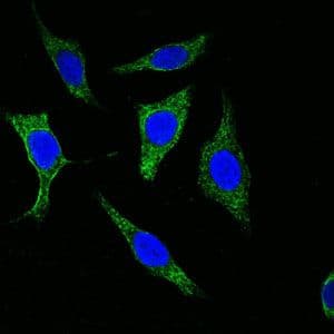 Pan Cytokeratin Antibody (clone 7H8)
