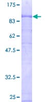 Human CIRH1A Protein (Recombinant GST)