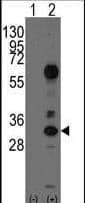 CD8A / CD8 Alpha Antibody (aa59-88)
