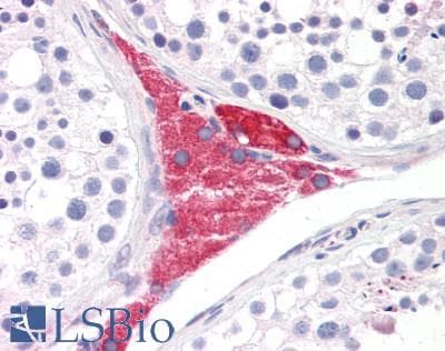 IHC-plus™ Polyclonal Rabbit anti-Human PAOX / PAO Antibody (aa467-496, IHC, WB)
