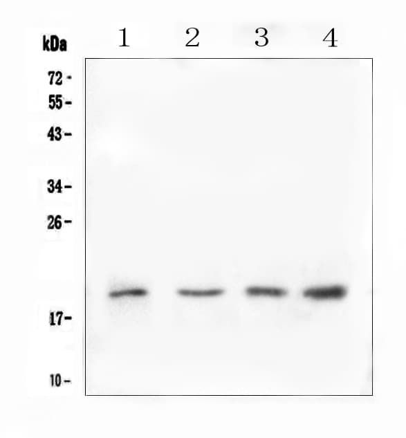 Polyclonal Rabbit anti-Human IL-10 Antibody (WB)