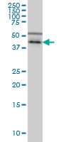 Monoclonal Mouse anti-Human CSNK1G1 / CKI-Gamma 1 Antibody (clone 3D1, IHC, WB)
