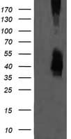 MAP2K3 / MEK3 / MKK3 Antibody (clone OTI3D10)