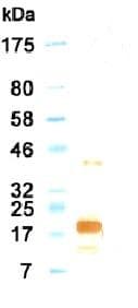 IL11 Antibody (clone KT8)