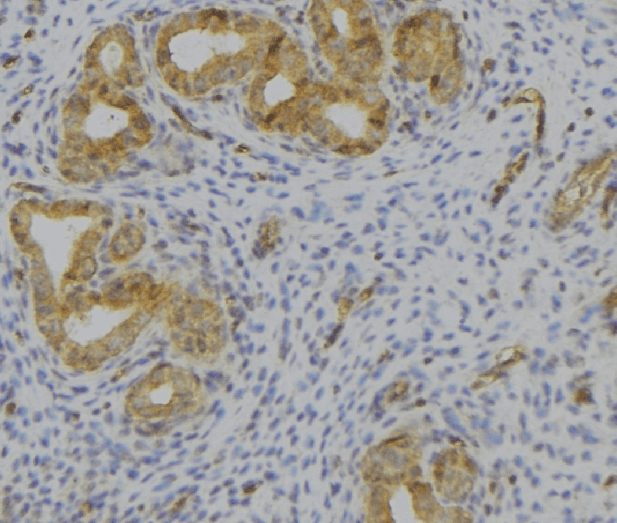 VIP Antibody