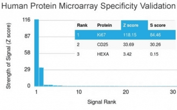 MKI67 / Ki67 Antibody (clone MKI67/2466, Ready-to-Use)
