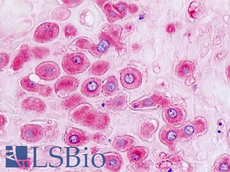 IHC-plus™ Polyclonal Rabbit anti-Human AKR1B1 / Aldose Reductase Antibody (aa241-290, IHC, WB)