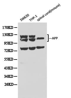APP / Beta Amyloid Precursor Antibody
