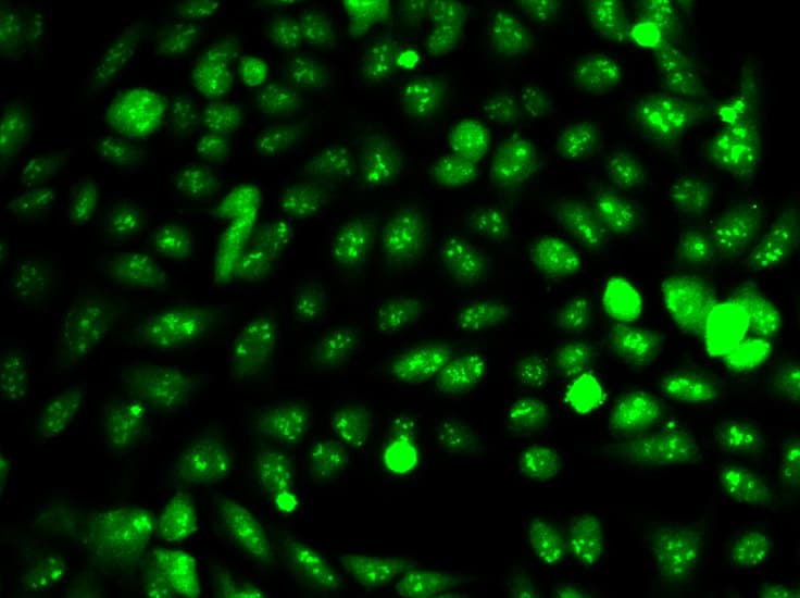 Polyclonal Rabbit anti-Human IDH1 / IDH Antibody (IHC, IF, WB)