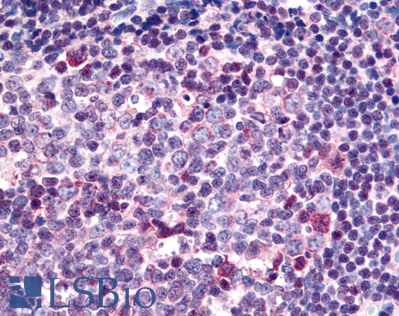 SARM1 / SARM Antibody