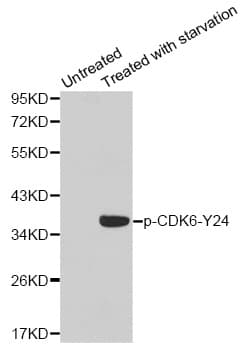 Polyclonal Rabbit anti-Human CDK6 Antibody (phospho-Tyr24, IHC, IF, WB)