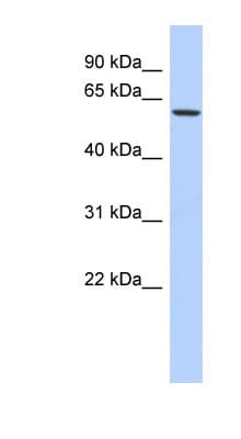 ELL / MEN Antibody (aa431-480)