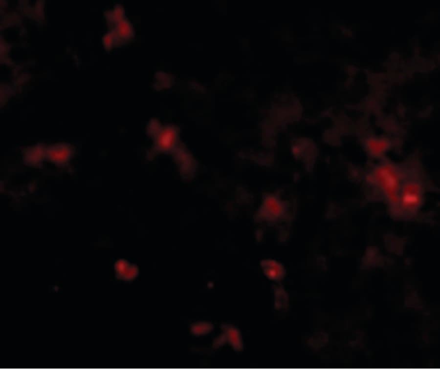 IHC-plus™ Polyclonal Rabbit anti-Human SYPL2 Antibody (IHC, IF, WB)