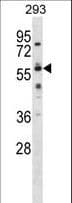 Polyclonal Rabbit anti-Human NELFB / COBRA1 Antibody (aa256-285, WB)