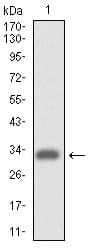 Monoclonal Mouse anti-Human ITGA4 / VLA-4 / CD49d Antibody (clone 5C4, WB)