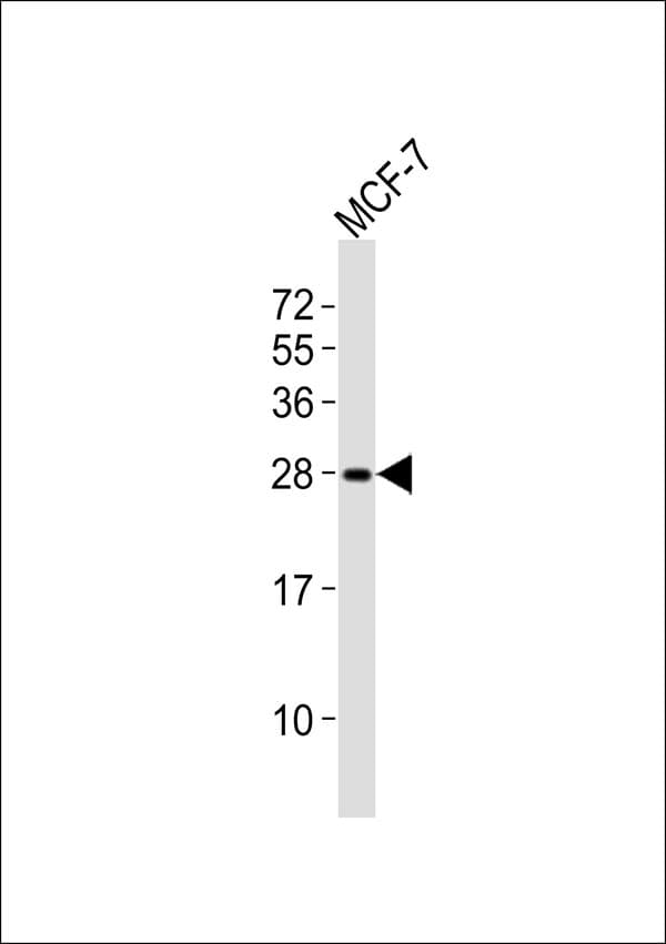 RAB20 Antibody