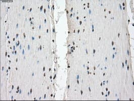 FCGR2 / CD32 Antibody (clone OTI19C10)