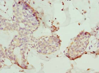 TMOD4 Antibody