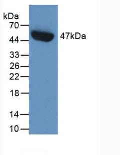 SERPINE1 / PAI-1 Antibody