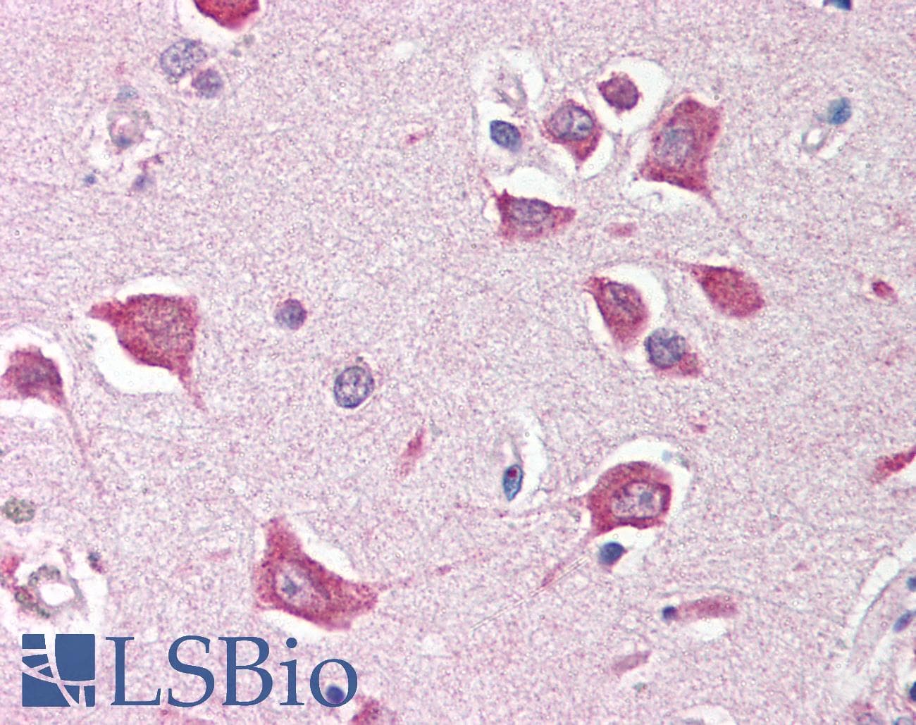 IHC-plus™ STK17B / DRAK2 Antibody