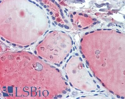 IHC-plus™ MPZL2 Antibody