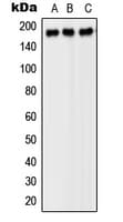 Polyclonal Rabbit anti-Human PDGFRB / PDGFR Beta Antibody (Internal, WB)