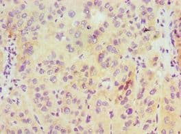 Polyclonal Rabbit anti-Human HDAC6 Antibody (aa160-470, IHC)