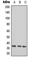 Talin 1+2 Antibody (Internal)