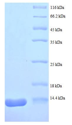 Mouse RETN / Resistin Protein (Recombinant His)