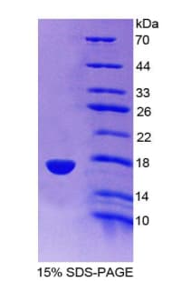 Rat SNCG / Gamma-Synuclein Protein (Recombinant His-T7)