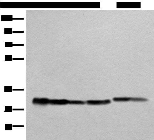 Polyclonal Rabbit anti-Human ATP5C1 Antibody (IHC, WB)