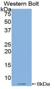 TMSB4X / Thymosin Beta-4 Antibody (aa1-44)