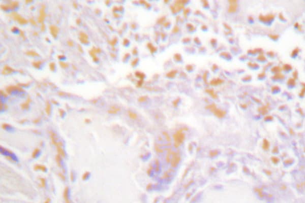 GATA2/3 Antibody (Lys304)