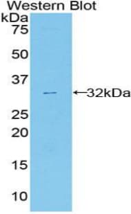 ANXA6/Annexin A6/Annexin VI Antibody (aa251-504)