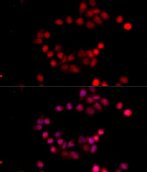 IHC-plus™ ETS1 / ETS-1 Antibody