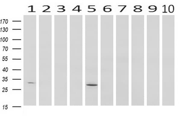 SDCBP / Syntenin Antibody (clone UMAB69)