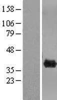 CLYBL Protein (Over-Expression Lysate Myc-DDK (Flag))