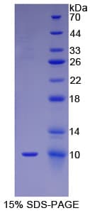 Human FGF3 Protein (Recombinant His)