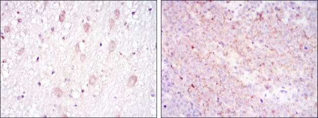 Monoclonal Mouse anti-Human CD1A Antibody (clone 7A7, IHC, IF, WB)