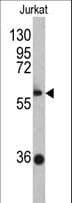 ZBTB2 Antibody (aa335-364)