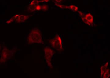 Polyclonal Rabbit anti-Human CHST13 Antibody (IHC, IF, WB)