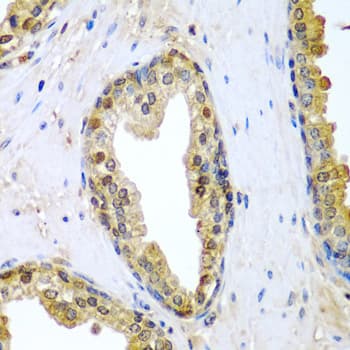 TNFSF10 / TRAIL Antibody