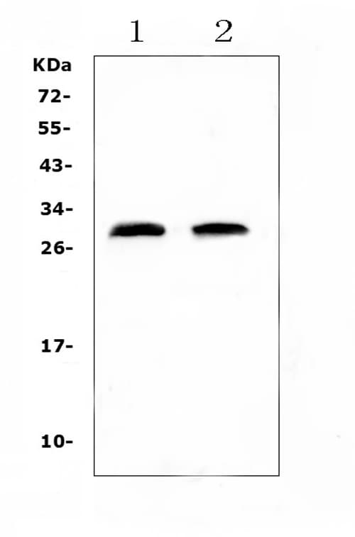Polyclonal Rabbit anti-Rat CRP / C-Reactive Protein Antibody (IHC, WB)