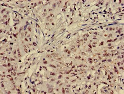 HIST1H4I Antibody