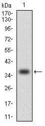Monoclonal Mouse anti-Human CCL2 / MCP1 Antibody (clone 2D8, IHC, IF, WB)